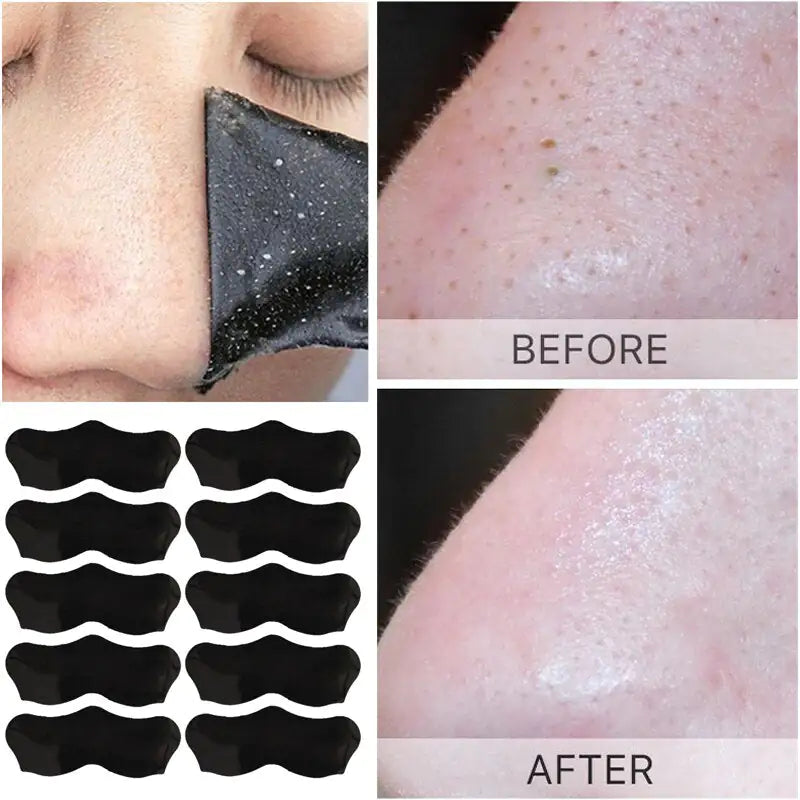 Charcoal Infused Nasal Blackhead Removal Strips