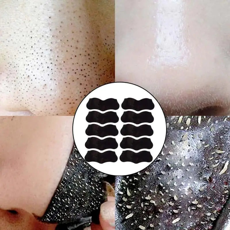 Charcoal Infused Nasal Blackhead Removal Strips